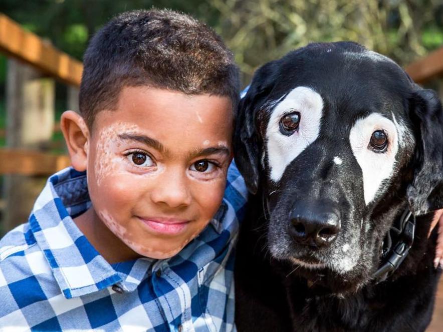Carter Blanchard, 8 ans, a appris à aimer sa peau avec l'aide d'un copain à fourrure